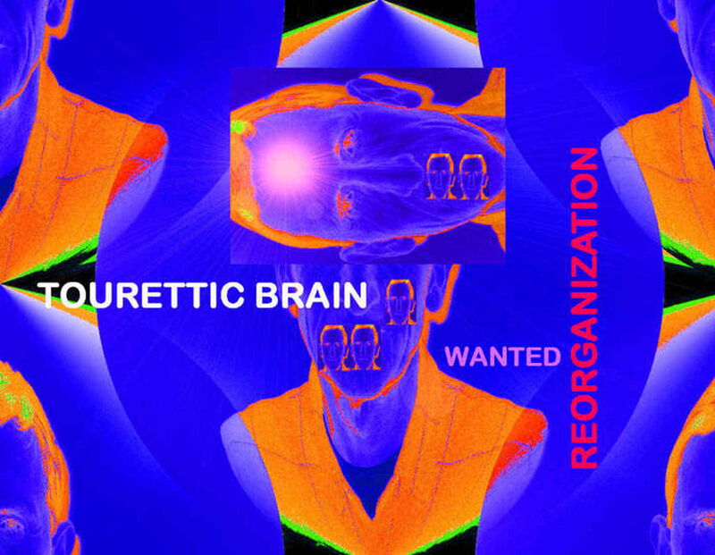 Fotomontage: Mehrere verschieden angeordnete, orange-blaue Köpfe und Oberkörper von Hermann.